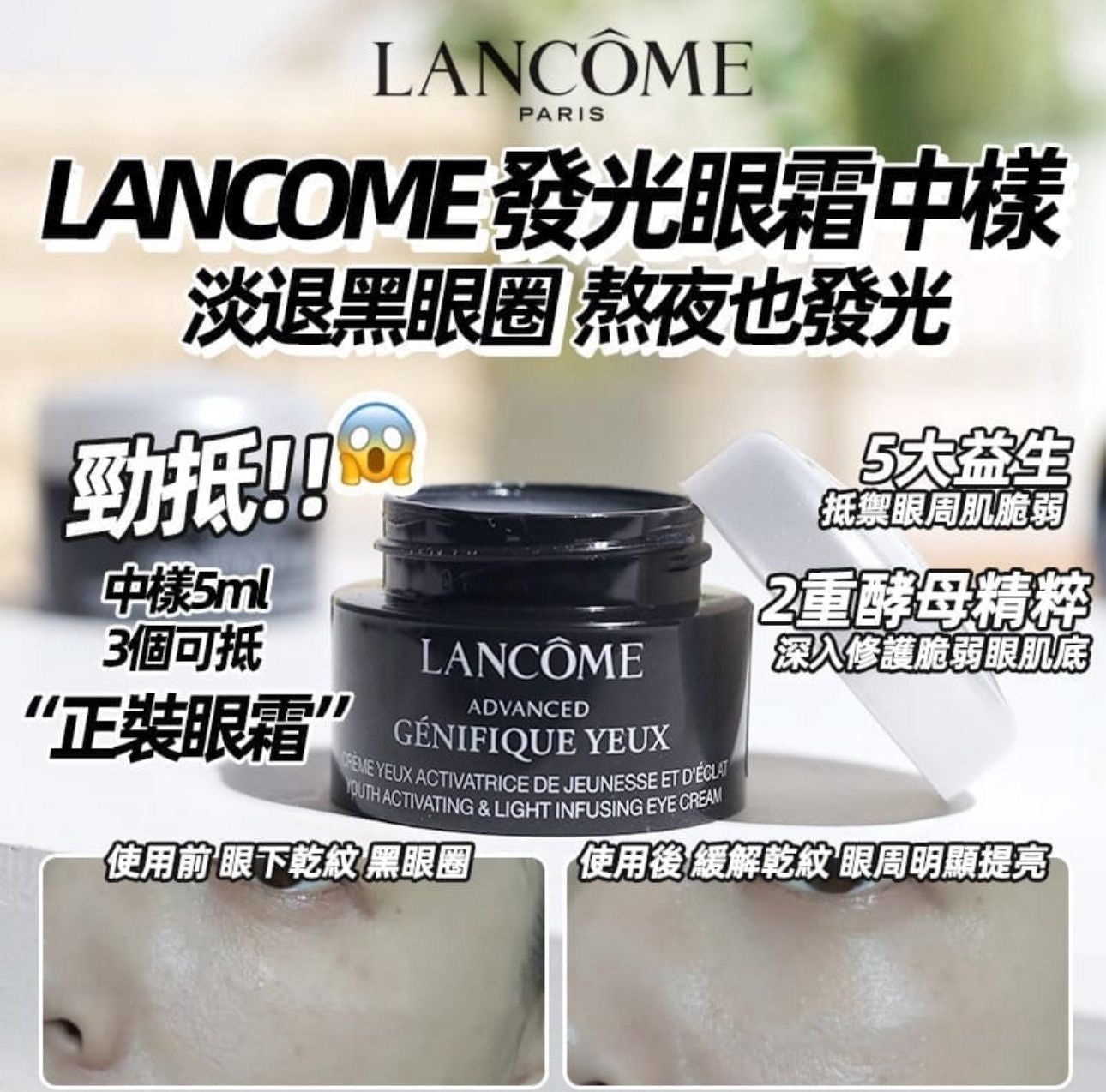 現貨❤️LANCOME 蘭蔻 小黑瓶Genifique升級版嫩肌活膚眼霜 (發光眼霜) 5ML
