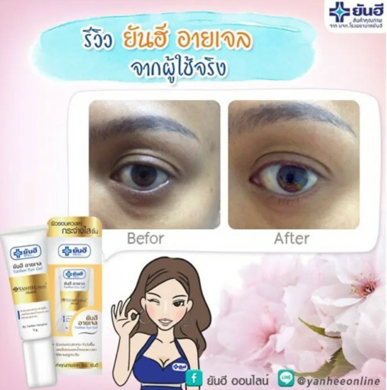 現貨❤️泰國 Yanhee Eye Gel然禧去黑眼圈眼霜 5g