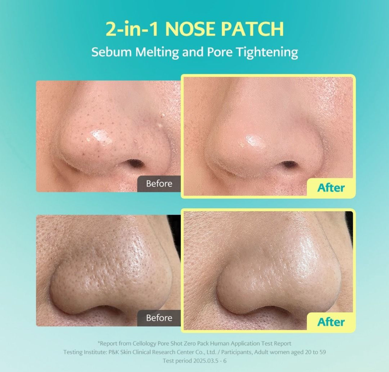 現貨❤️韓國 Cellology PORE SHOT 毛孔狙擊ZERO貼片8入