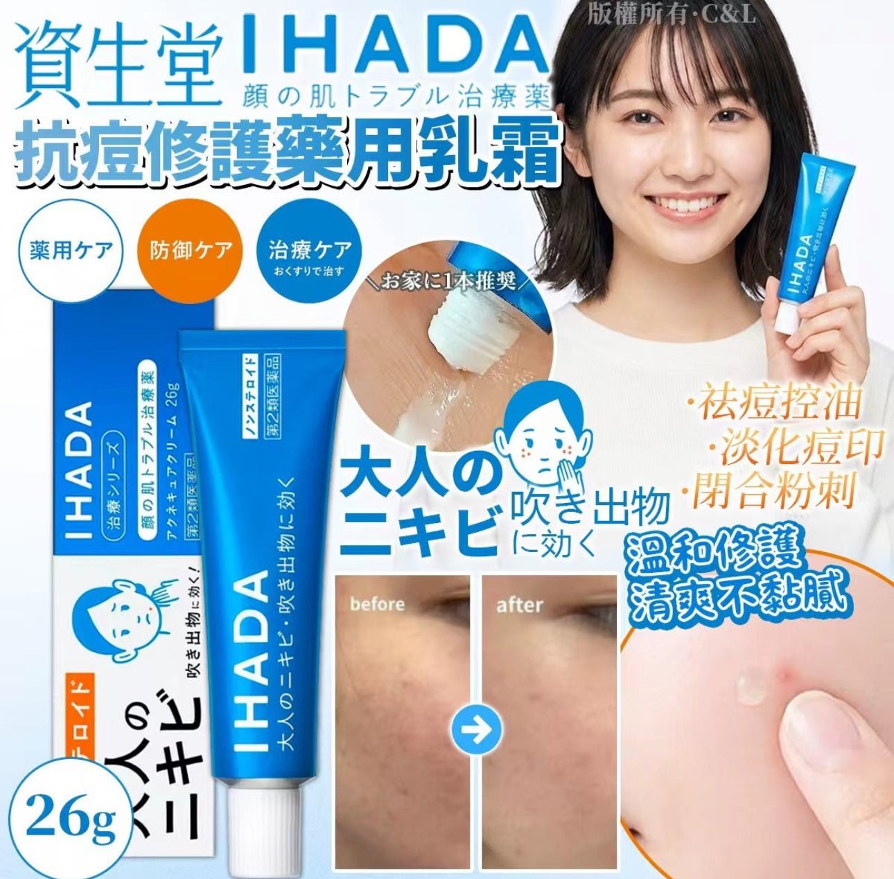 現貨❤️資生堂 IHADA 祛痘霜 26g