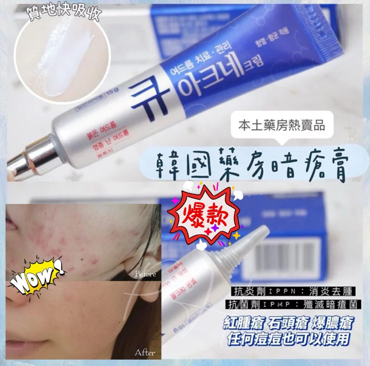 現貨❤️韓國本土藥房熱賣 Q Acne 消炎祛痘膏15g