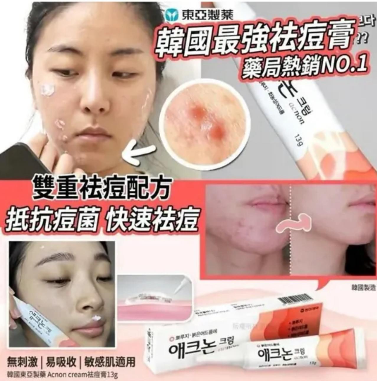 現貨❤️韓國東亞製藥 Acnon Cream 袪痘膏 13g