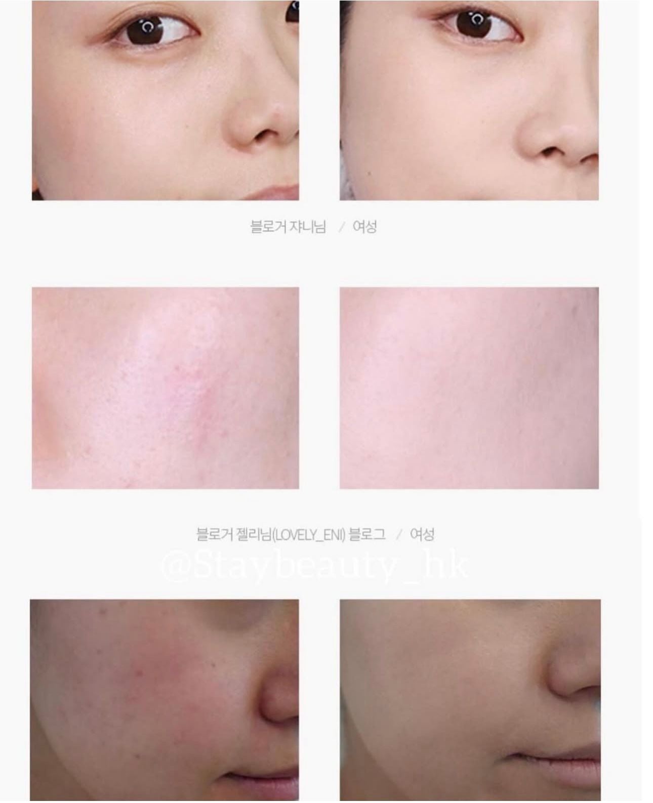 現貨❤️Olive Young 皇牌遮瑕膏HANSKIN Blemish Cover 完美保濕遮瑕膏 12g