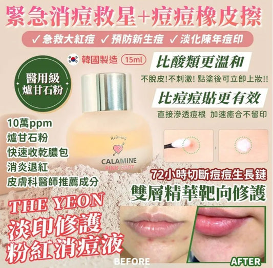 現貨❤️The YEON 韓國 速效粉紅痘痘修復液 15ml
