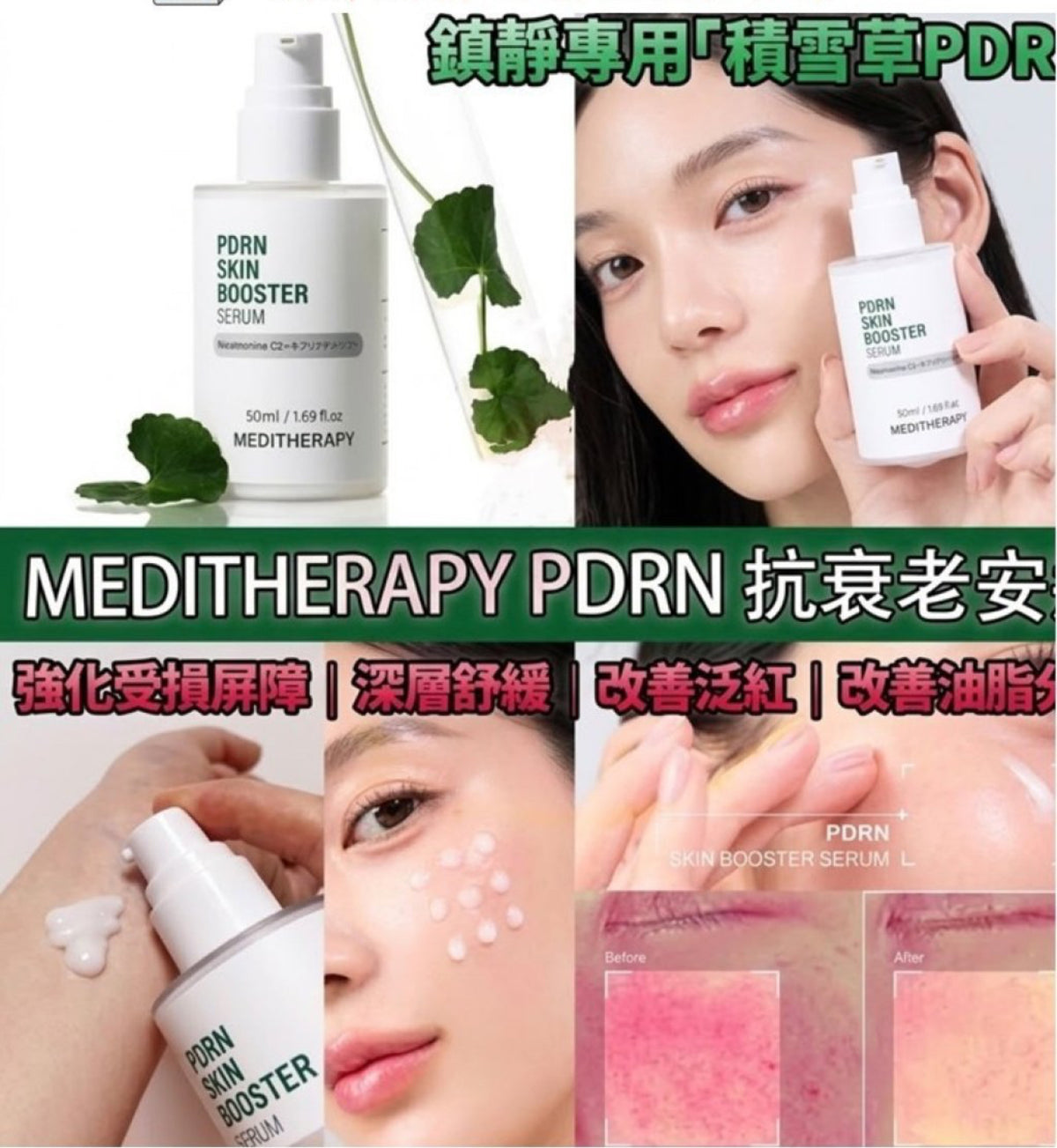 現貨❤️韓國🇰🇷直送MEDITHERAPY PDRN 抗衰老修護再生精華100ml