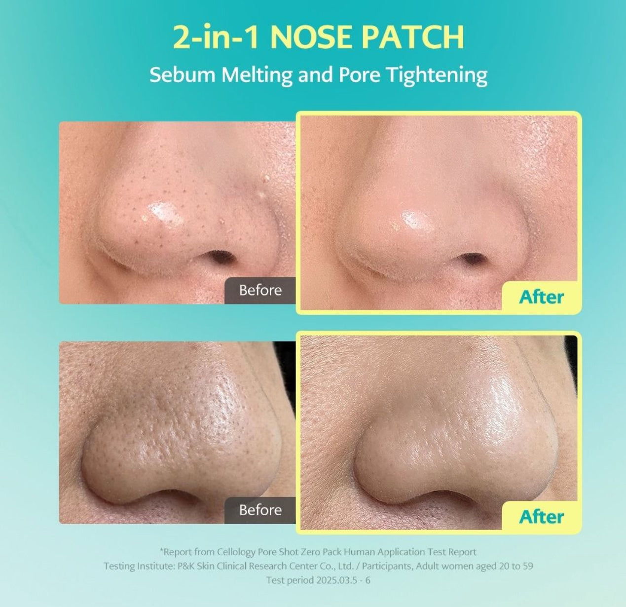 現貨❤️Cellology PORE SHOT 毛孔狙擊ZERO貼片8入