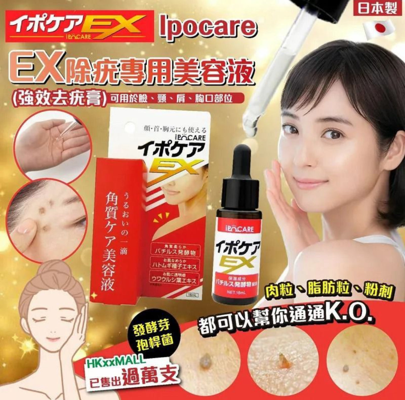 現貨❤️日本IPOCARE EX 高機能去角質粒去疣美容液 18ml