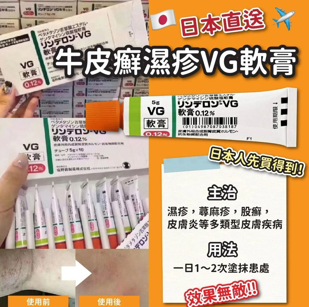 現貨❤️日本牛皮癬濕疹VG軟膏 （大人版）