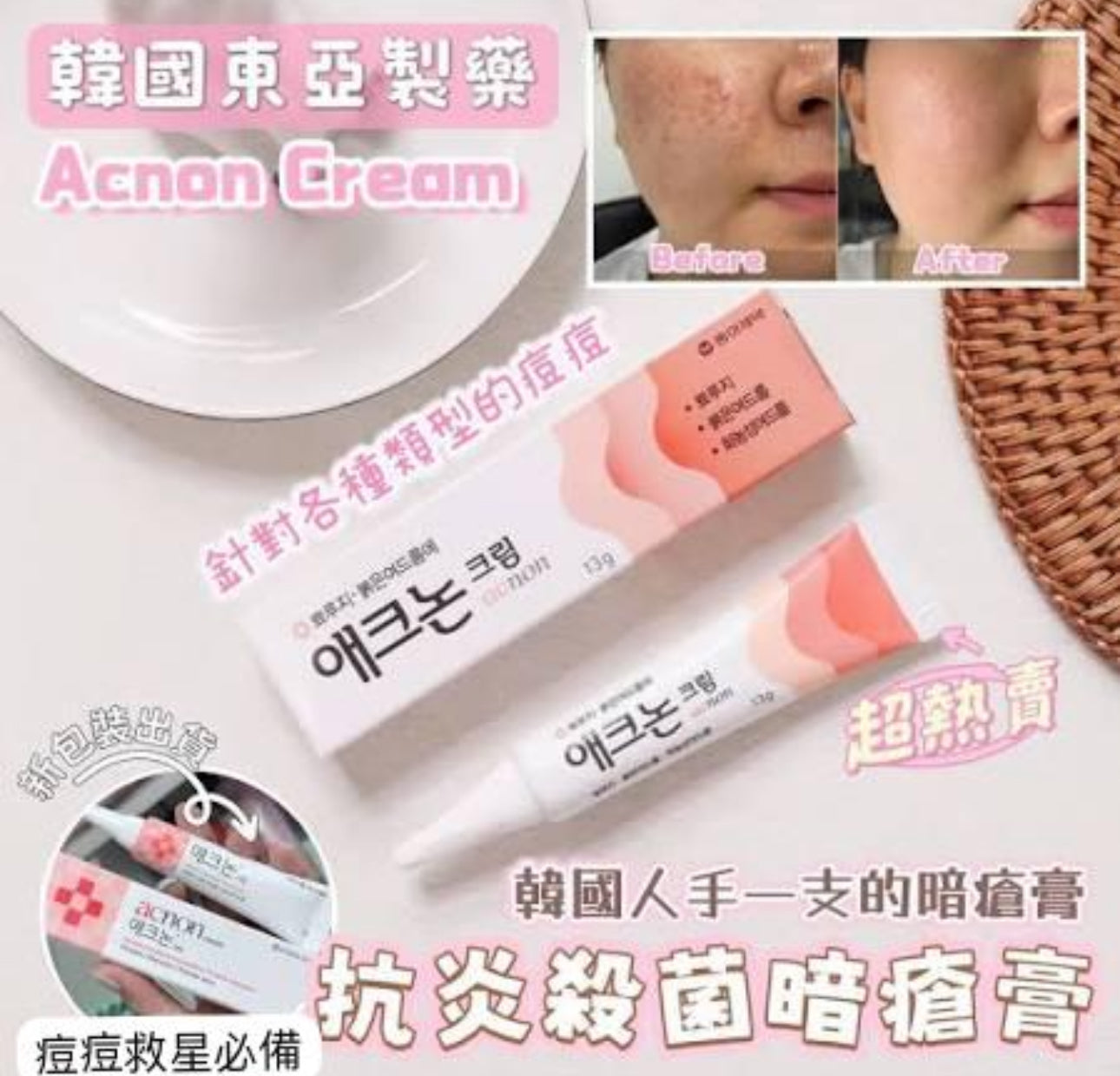 現貨❤️韓國東亞製藥 Acnon Cream 袪痘膏 13g