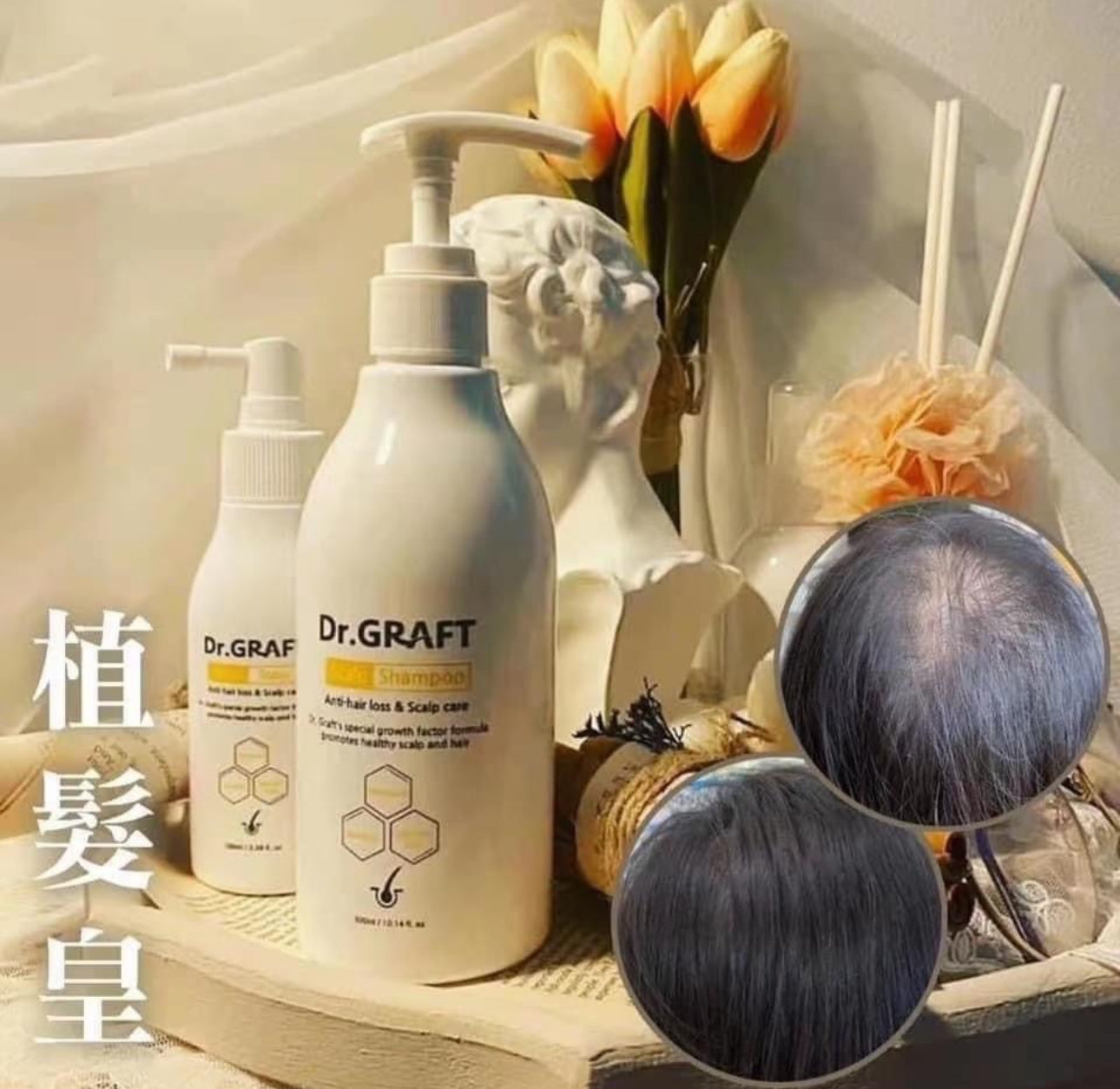 現貨❤️韓國🇰🇷Dr.GRAFT 植髮皇套（植髮孕育洗頭水 300ml + 植髮孕育精華 100ml ）